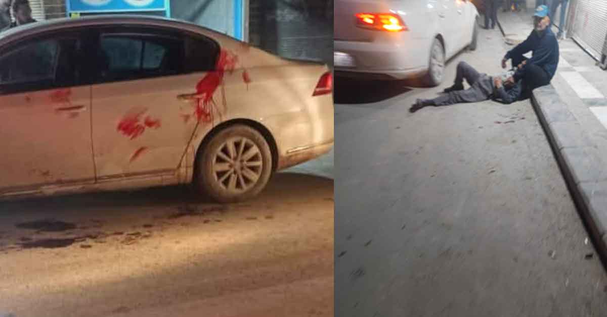 Şanlıurfa'da Sigara Fiyatı Kavgasında Kan Döküldü 8 Şanlıurfa'da Sigara Fiyatı Kavgasında Kan Döküldü
