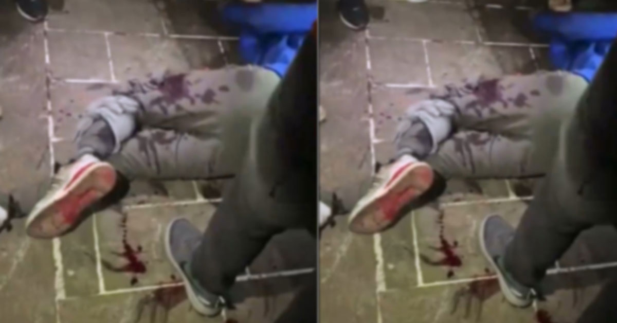 Urfa'da Suriyeli Şahsın Ayağına Sıktılar