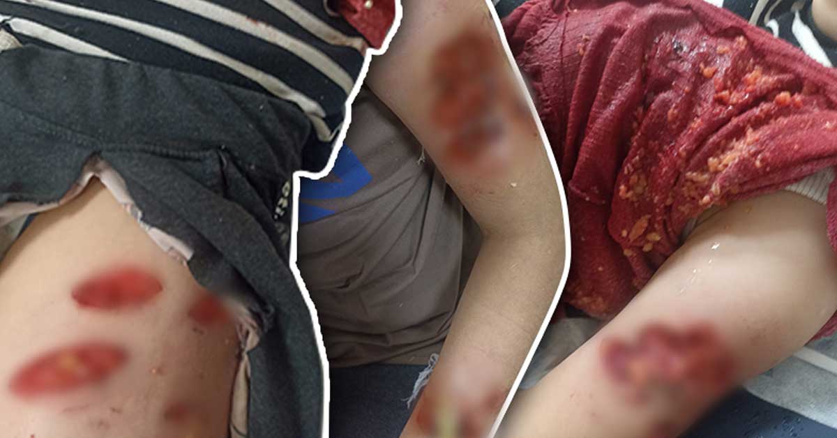 Urfa'da Kız Çocuğuna Başıboş Köpekler Saldırdı 9 Urfa'da Kız Çocuğuna Başıboş Köpekler Saldırdı